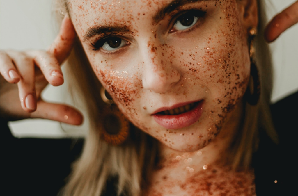 bye bye acne