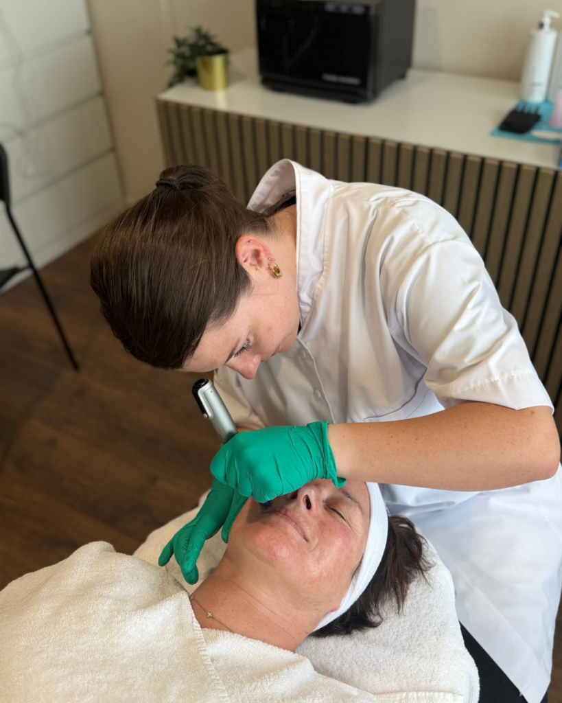 korean microneedling